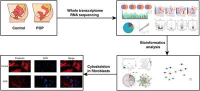 Construction of a focal adhesion signaling pathway-related ceRNA network in pelvic organ prolapse by transcriptome analysis